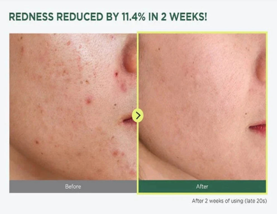 Anua Heartleaf 77% Soothing Toner - 250ml